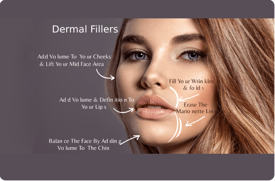Dermal Fillers 