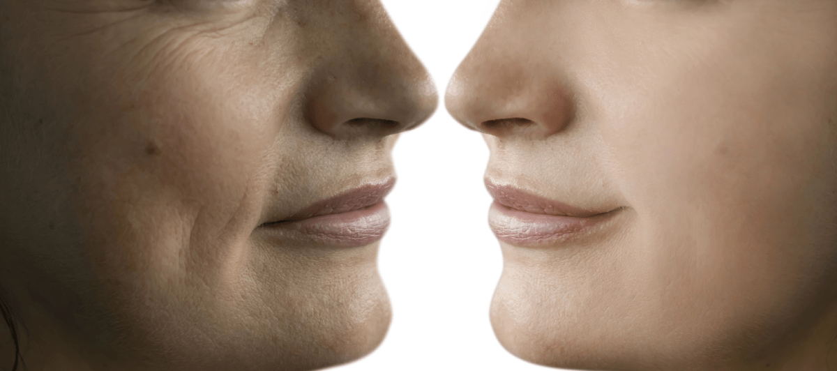 Anti-Wrinkle Treatments