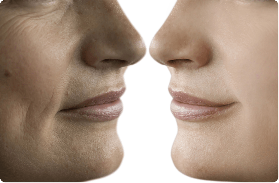 Anti-Wrinkle Treatments