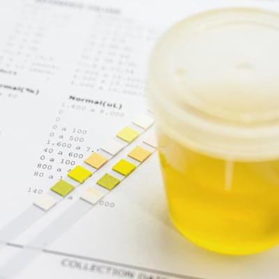DRUG TESTING