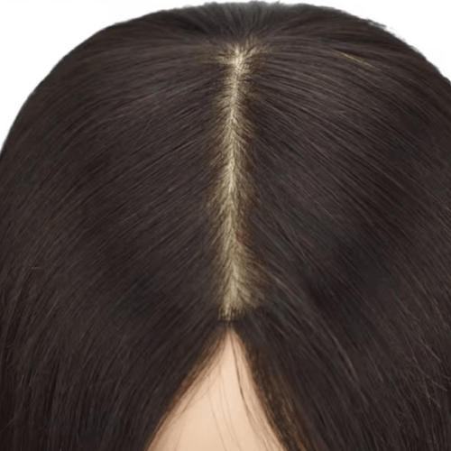 Alopecia Treatment Services