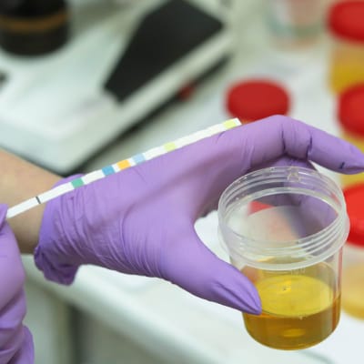 DRUG SCREENING SERVICES