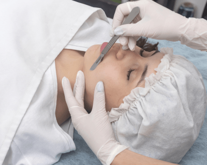DERMAPLANING