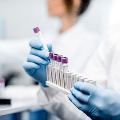 TB TESTING