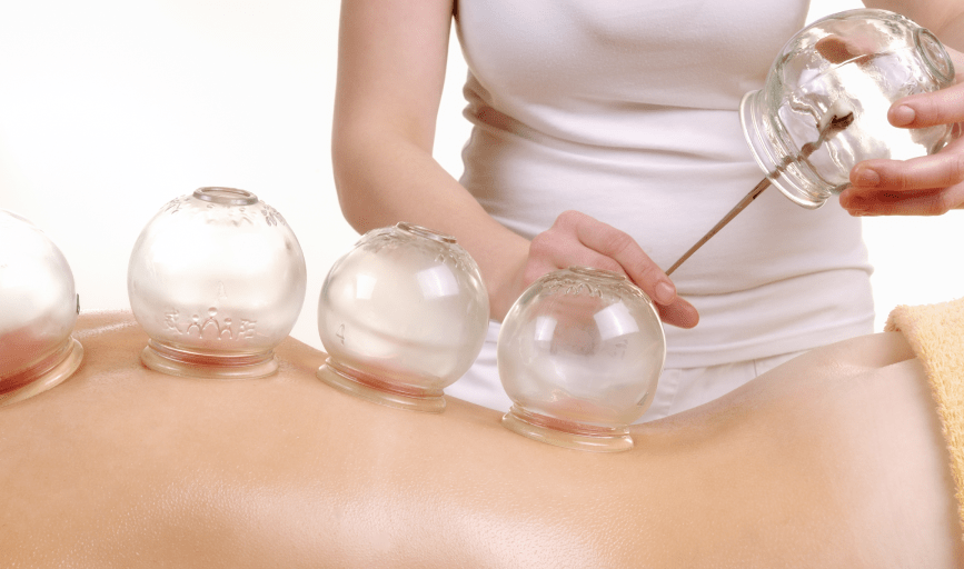 CUPPING THERAPY