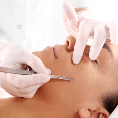 DERMAPLANING