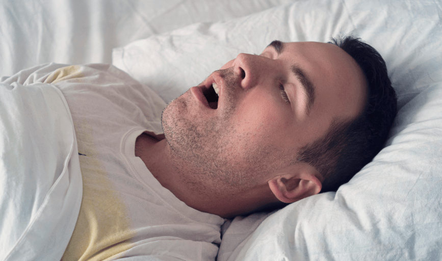 SNORING TREATMENT
