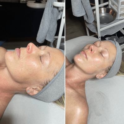 HYDRATING FACIALS