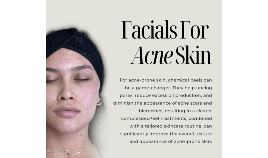 ANTI-ACNE FACIALS