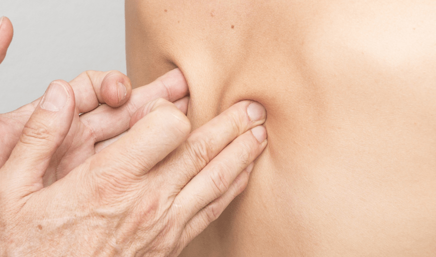 TRIGGER POINT MASSAGE