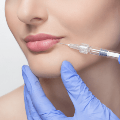 LIP FILLERS