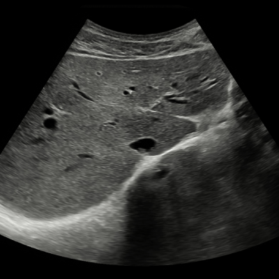 General Ultrasound Screening