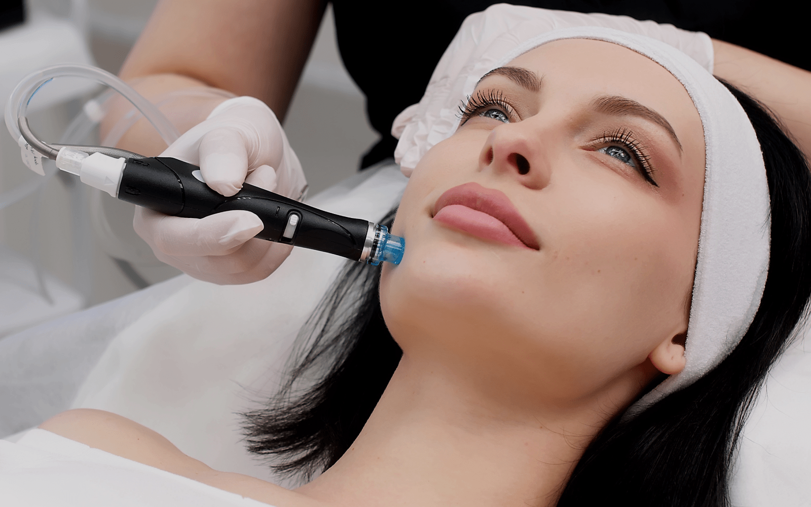 Microneedling