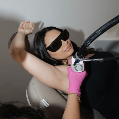 UNDERARM LASER HAIR REMOVAL