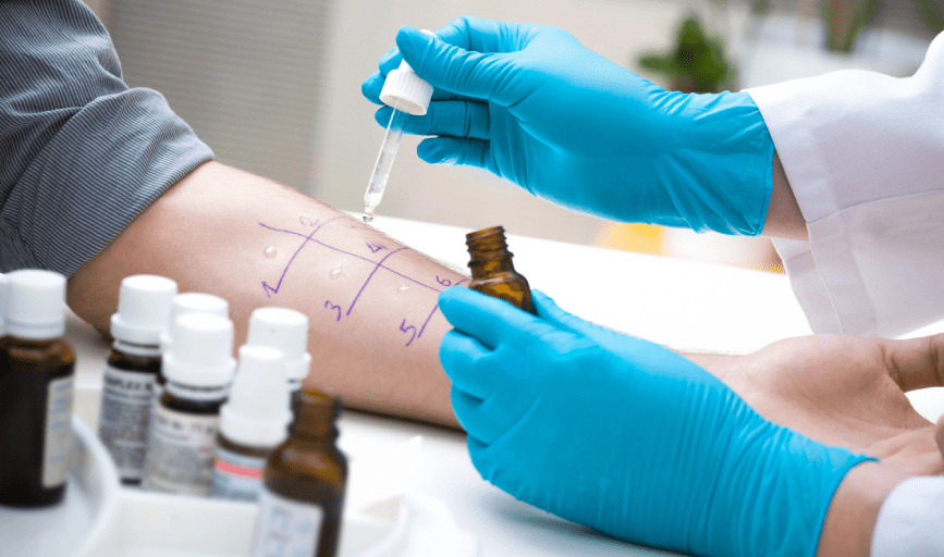 ALLERGY TESTING SERVICE