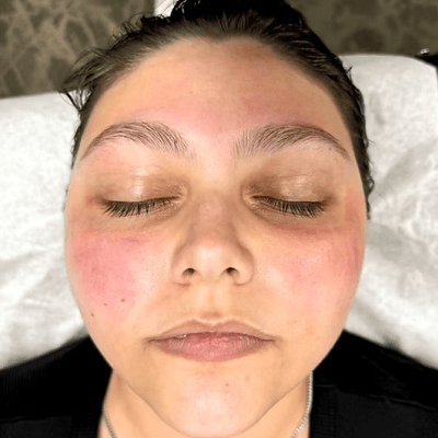 FACIALS