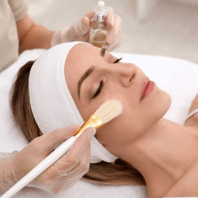 CHEMICAL PEEL TREATMENT