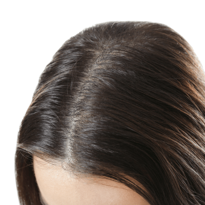 TED HAIR RESTORATION