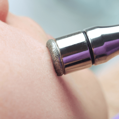 MICRODERMABRASION SERVICES