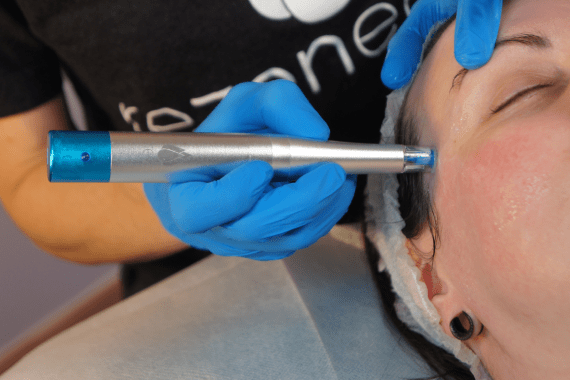 Relaxing Rejuvenations