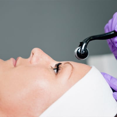 Microneedling