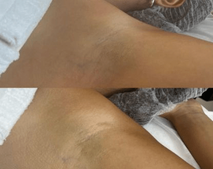 SKIN LIGHTENING SERVICES