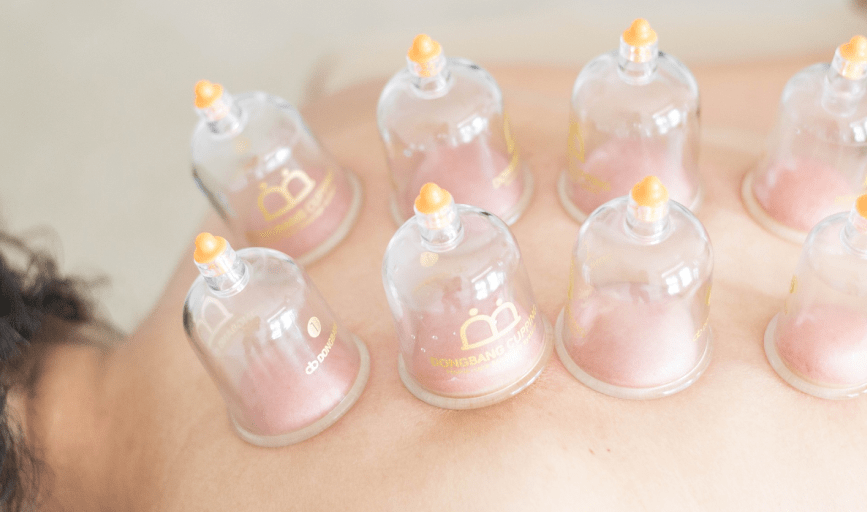 MEDICAL CUPPING