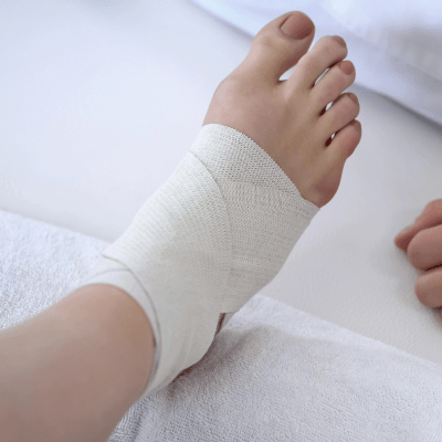 FOOT ULCER TREATMENT