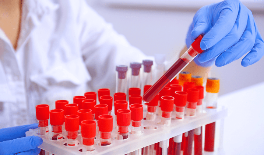 BLOOD SAMPLE TRANSPORT