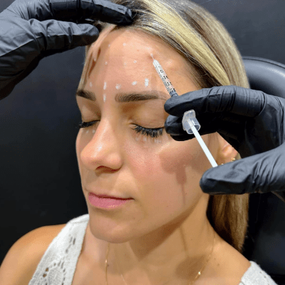 BOTOX INJECTIONS