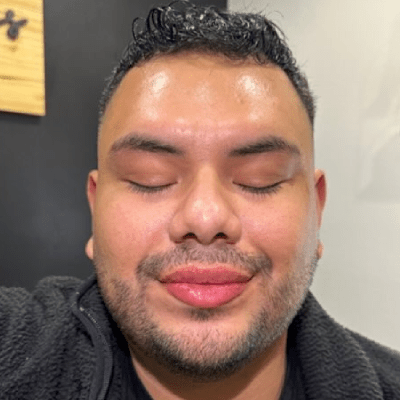 LIP FILLERS