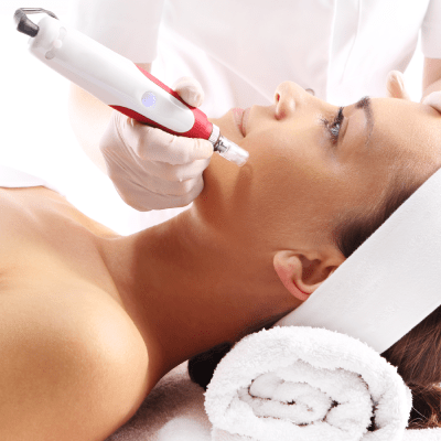 MICRONEEDLING