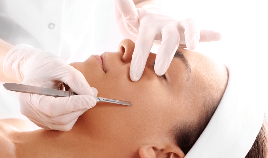 DERMAPLANING