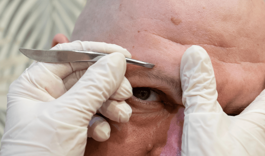 EYEBROW TRIMMING