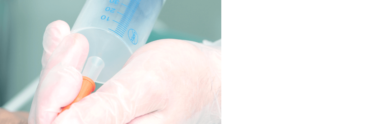 Tube Feeding Assistance