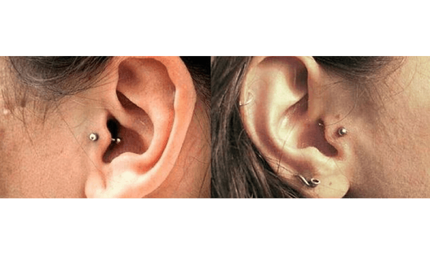 Xolotl Tattoo Gallery