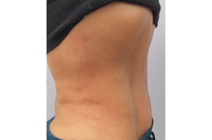 Simply Her Aesthetics & Beauty