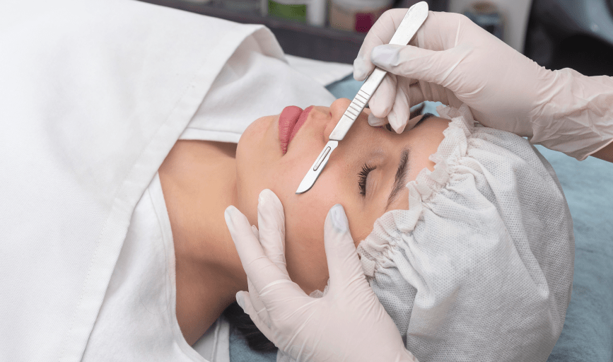DERMAPLANING