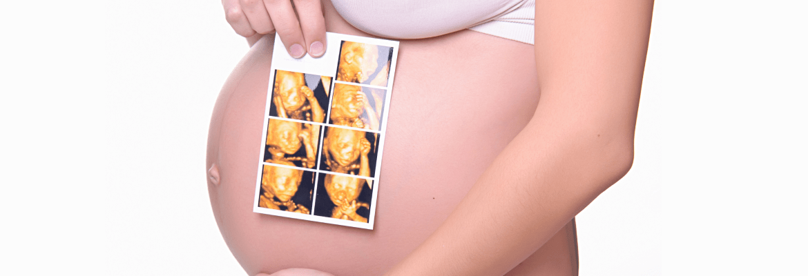 Butterfly Kisses Fetal Imaging Studio