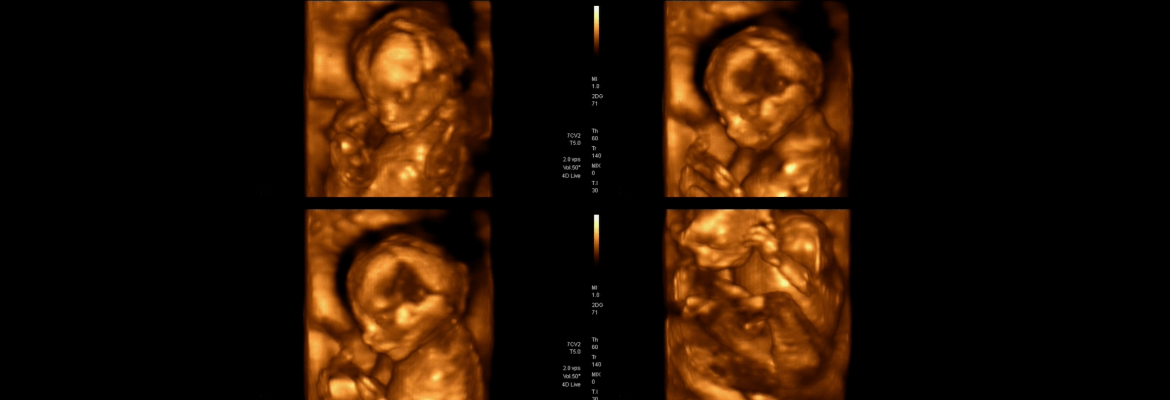 Butterfly Kisses Fetal Imaging Studio