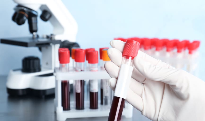 Diagnostic Blood Testing