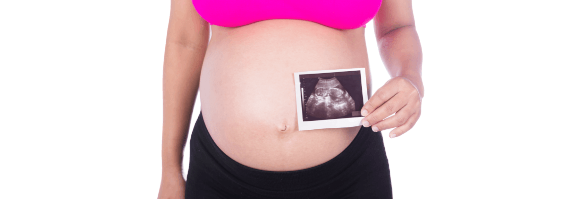 Butterfly Kisses Fetal Imaging Studio