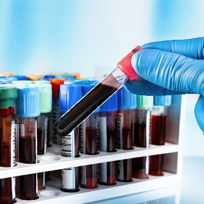 Blood Tests