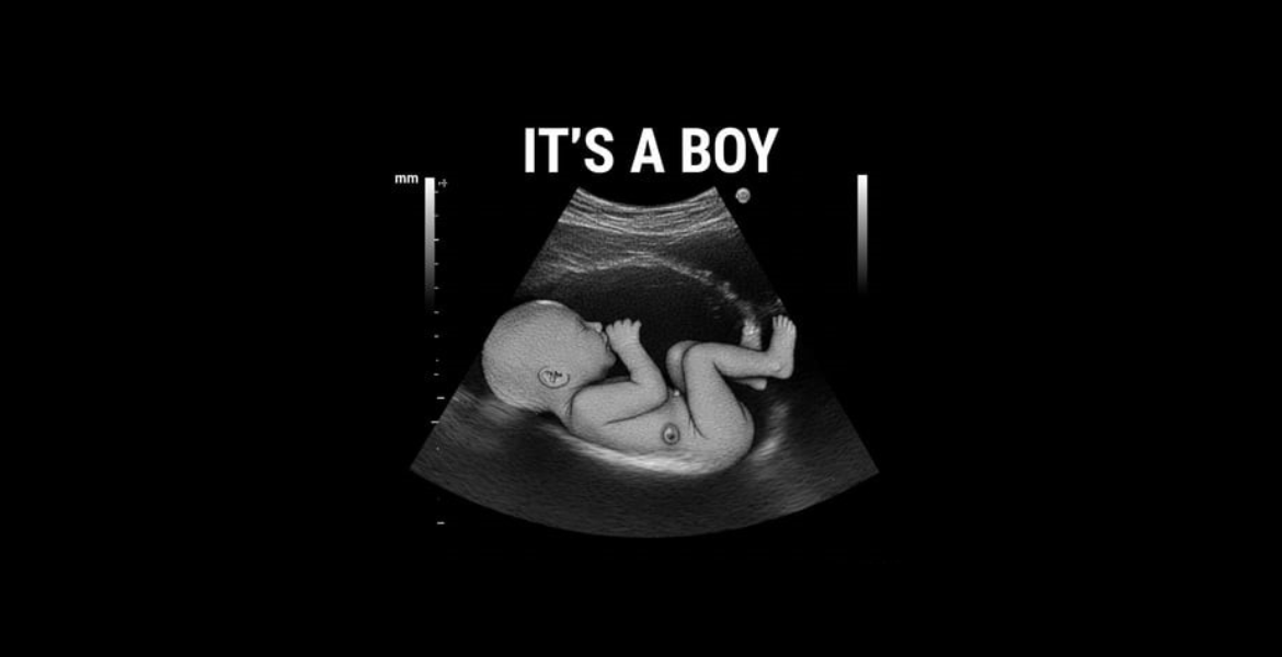 Sweet Peek Baby Boutique 3D Imaging