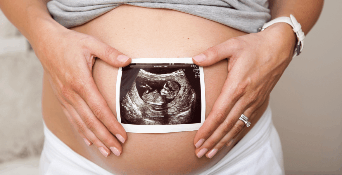 Sweet Peek Baby Boutique 3D Imaging