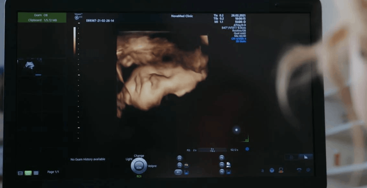 Sweet Peek Baby Boutique 3D Imaging