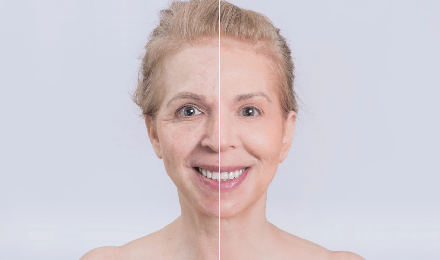 Anti-Aging Treatment