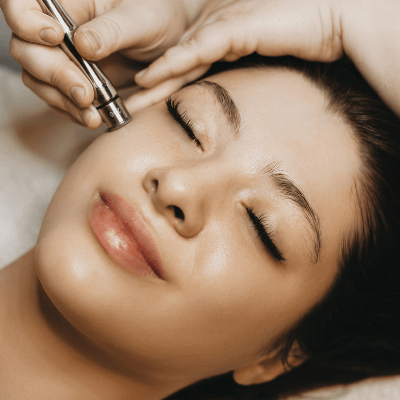 Microdermabrasion