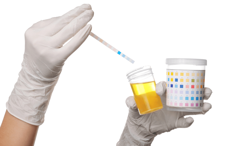DOT DRUG TESTING