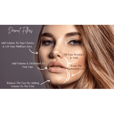 DERMAL FILLERS 